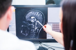 Denton Traumatic Brain Injury (TBI) Lawyer