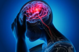 Anna Traumatic Brain Injury (TBI) Lawyer